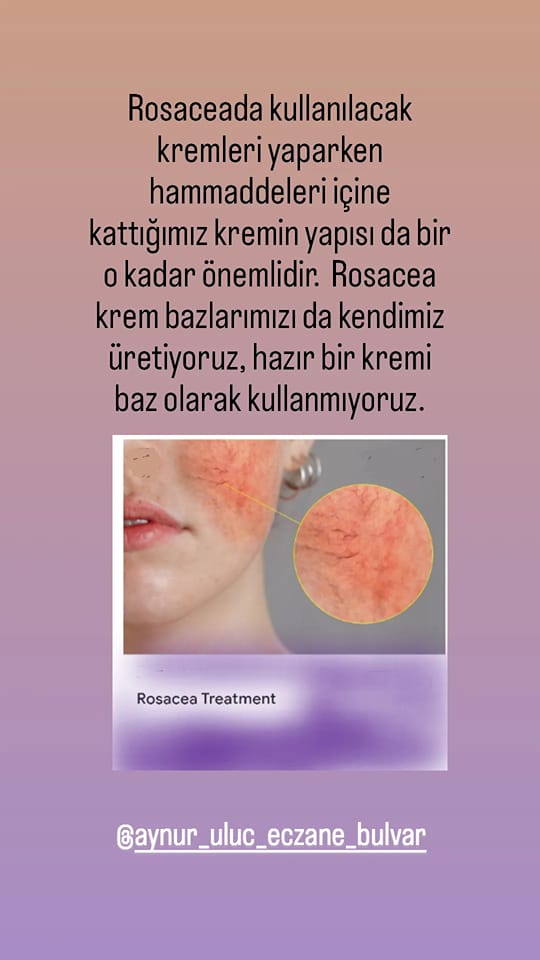 Rosacea Treatment